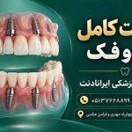 ایمپلنت کامل هر دو فک در کلینیک دندانپزشکی ایرانادنت مشهد